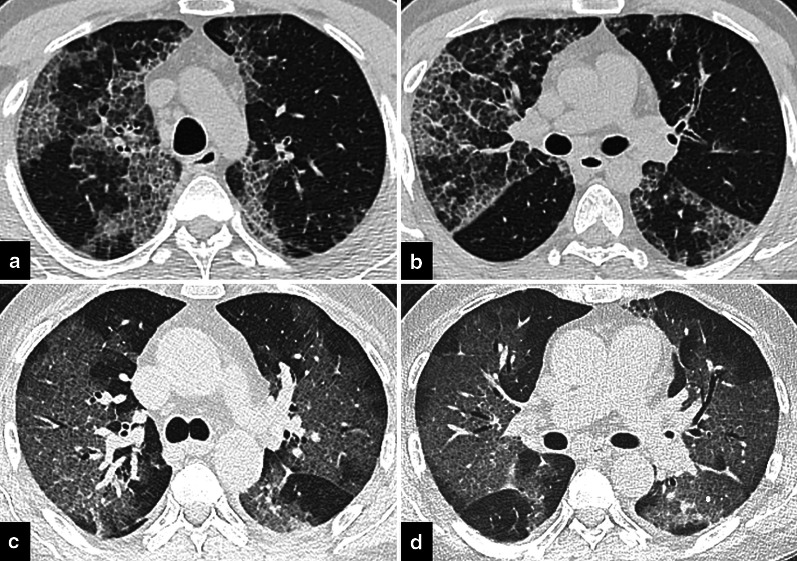 Fig. 12