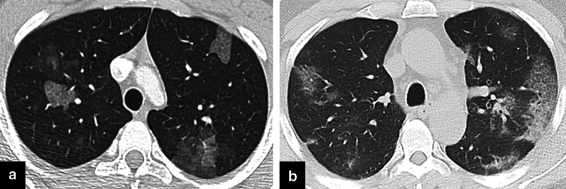 Fig. 9