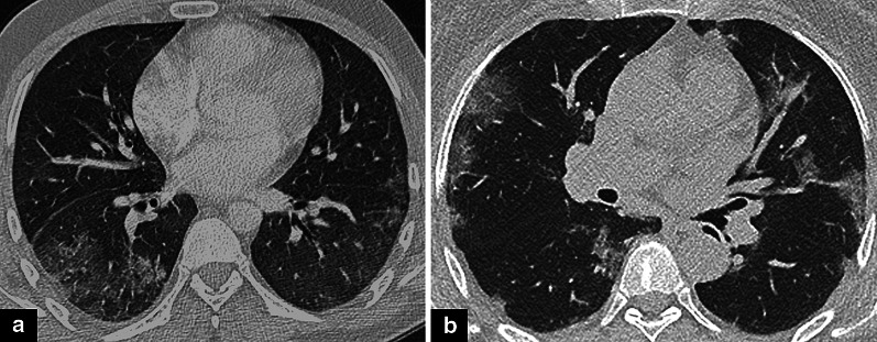 Fig. 11