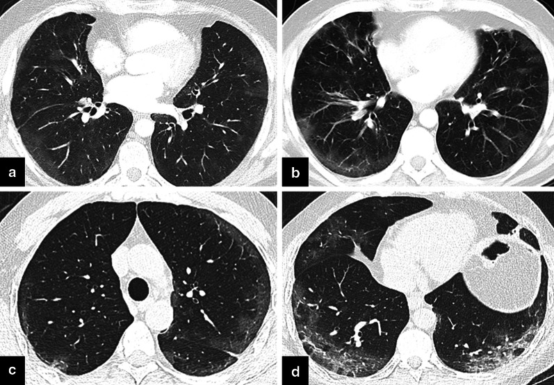 Fig. 15