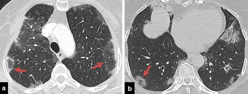 Fig. 13