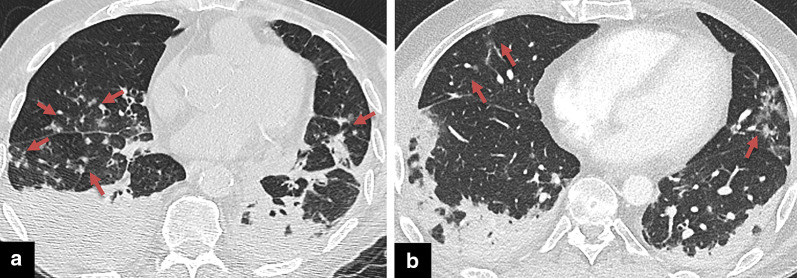 Fig. 17