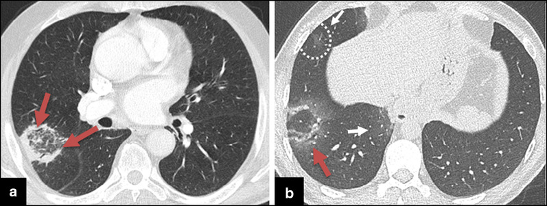 Fig. 10