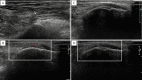 Fig.2