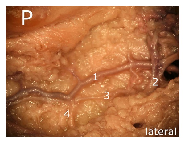 Figure 14