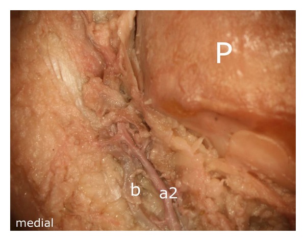 Figure 13