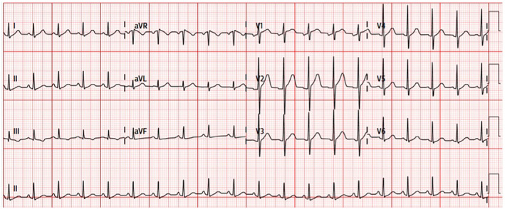 FIGURE 1