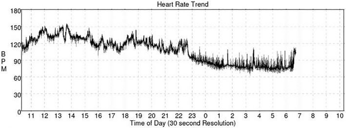 FIGURE 3