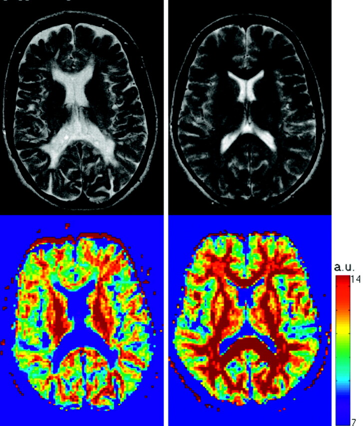 Fig 4.