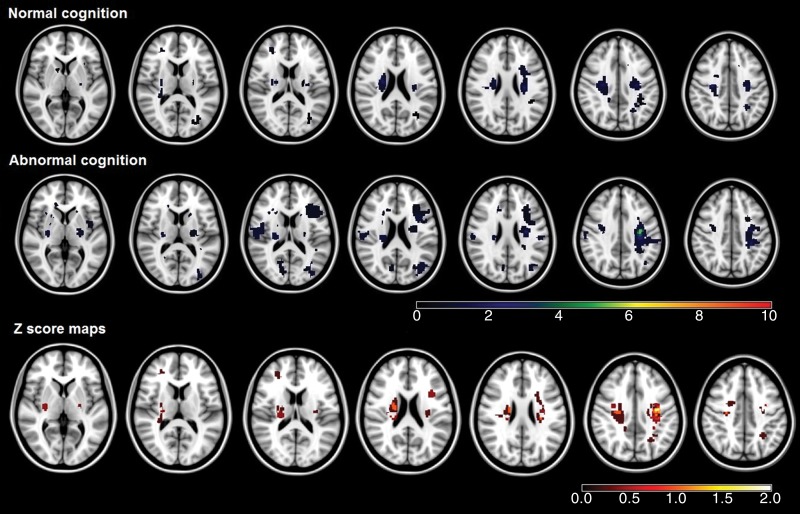 Figure 1a: