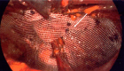 Fig. 3