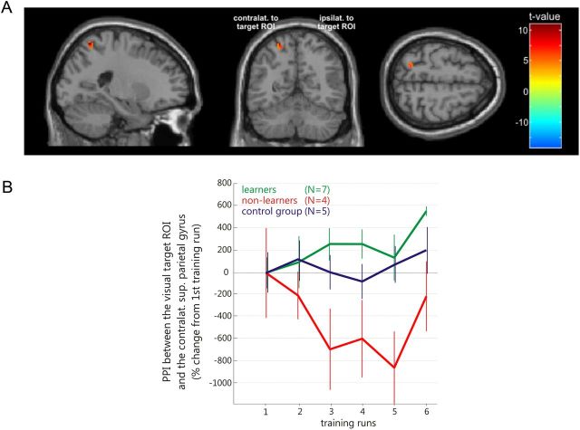 Figure 11.