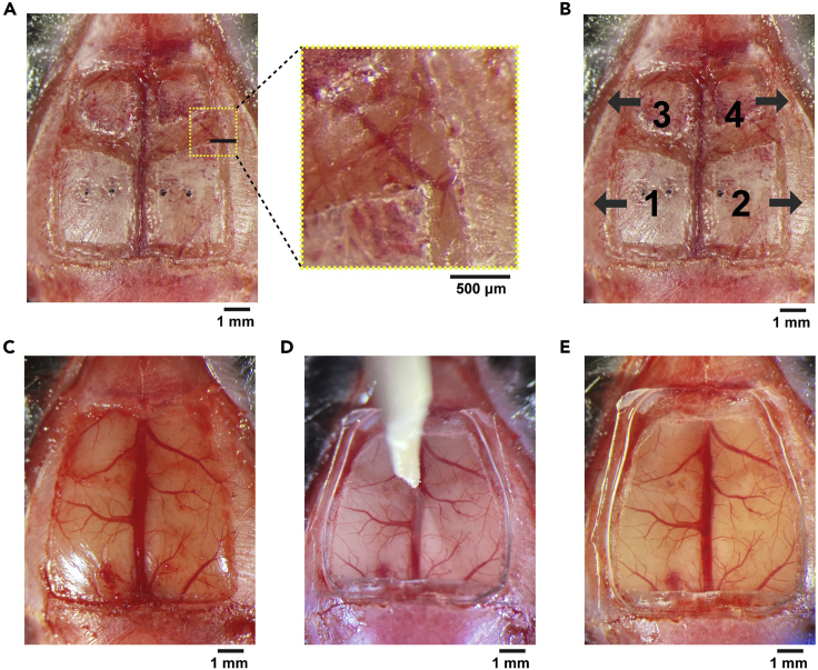 Figure 4