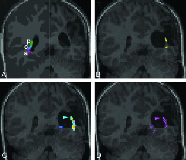 Fig 3.