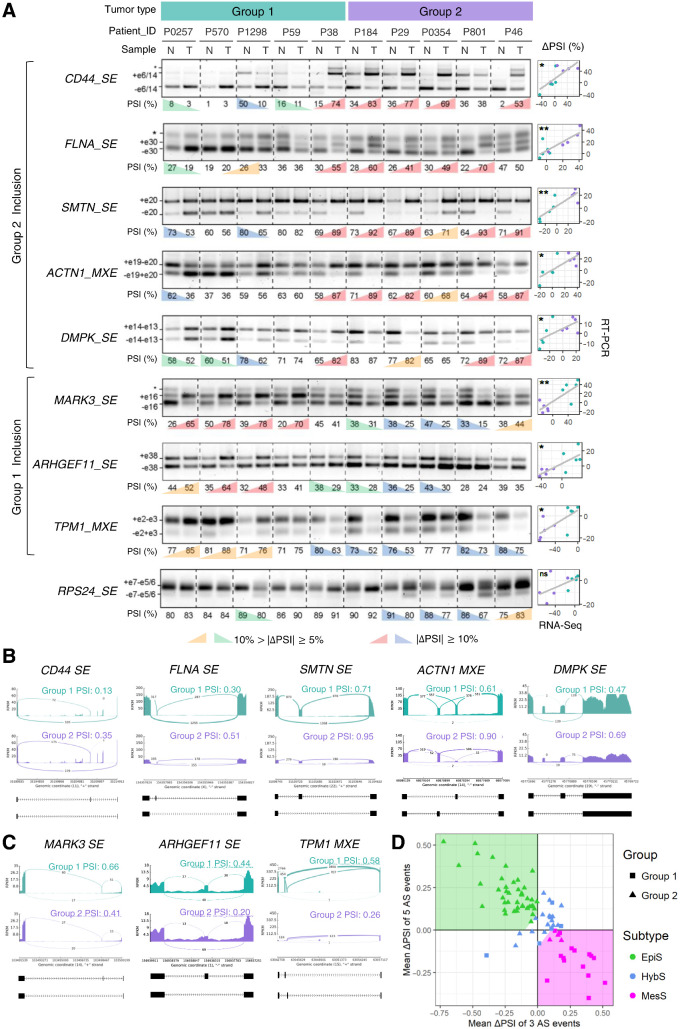 Figure 2. Eight AS events display distinct patterns in two patient groups. A, RT-PCR validation of AS events in gastric tumors (T) and matched normal (N) tissues from 10 patients, using primers that amplify both included and skipped isoforms. For each AS event, a representative gel image is shown along with PSI values, calculated as the percentage of included/(%included + %skipped); significant ΔPSI (T–N) values (n = 3, ΔPSI >|10%| and ΔPSI >|5%|) are colored. Exons included (+) or skipped (−) are annotated (*, bands of no interest). Correlations of ΔPSI values between RT-PCR and RNA-seq experiments are shown on the right. *, P < 0.05; **, P < 0.01; ns, not significant. B and C, Read coverage and junction reads showing inclusion of AS events that define “Group 2” (B) and “Group 1” (C) in gastric tumors. Gene name and AS type are indicated, along with average PSI for tumors. D, Scatter plot of patients using mean(ΔPSI; Group 2 vs. 1). The areas for three subtypes are shown in different background colors—EpiS, green; MesS, magenta; and HybS, white, where the x and y intercepts of linear boundaries are 0.1.