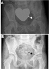 Fig. (5)