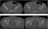 Fig. (1)