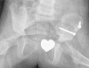 Fig. (2)