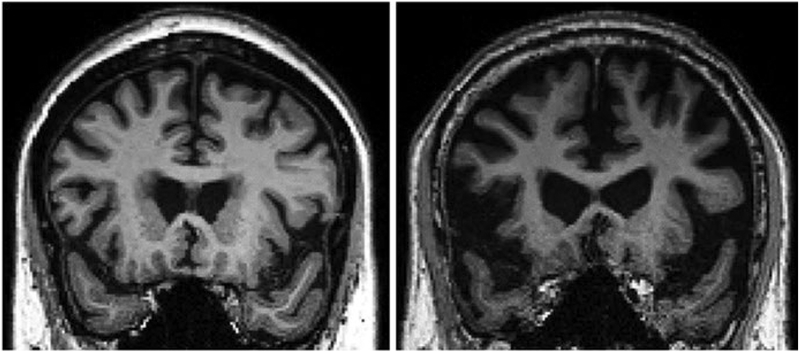 Fig. 2.3