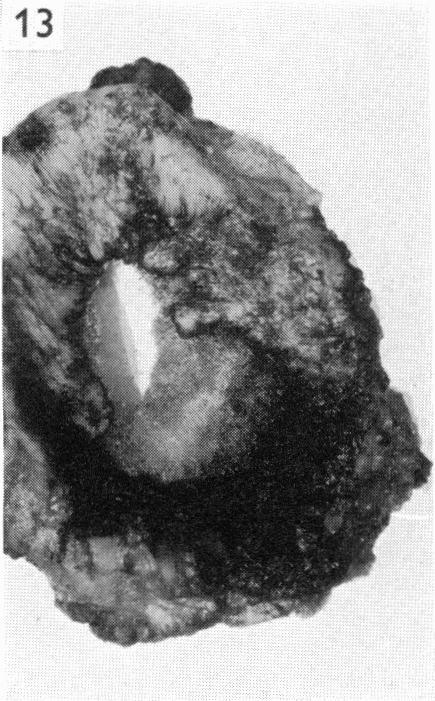 Fig. 13