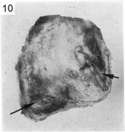 Fig. 10