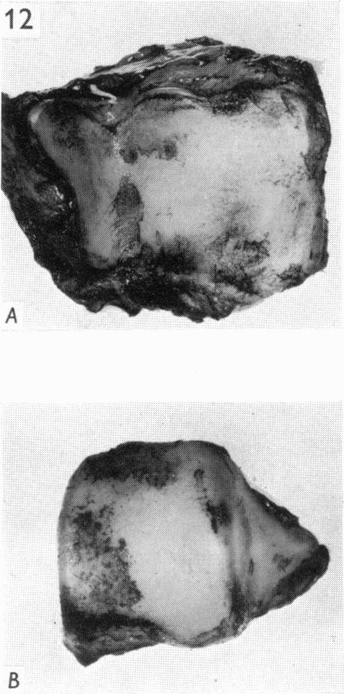 Fig. 12