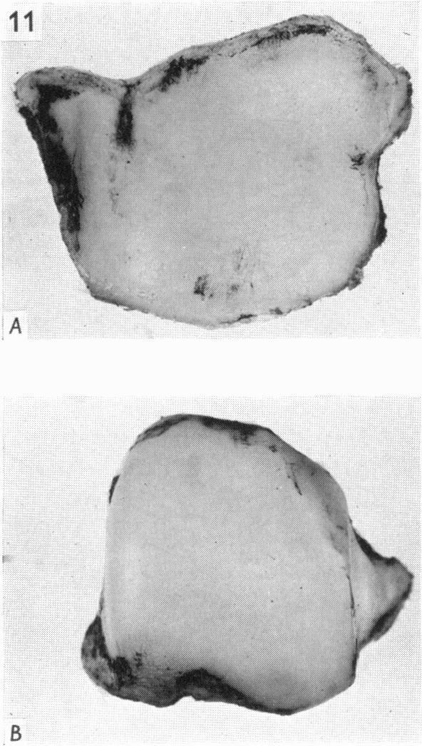 Fig. 11