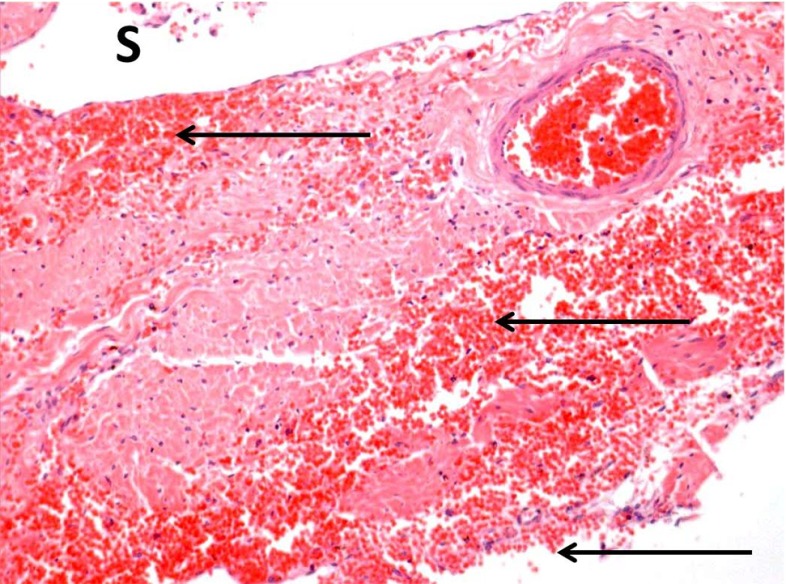 Fig. 19