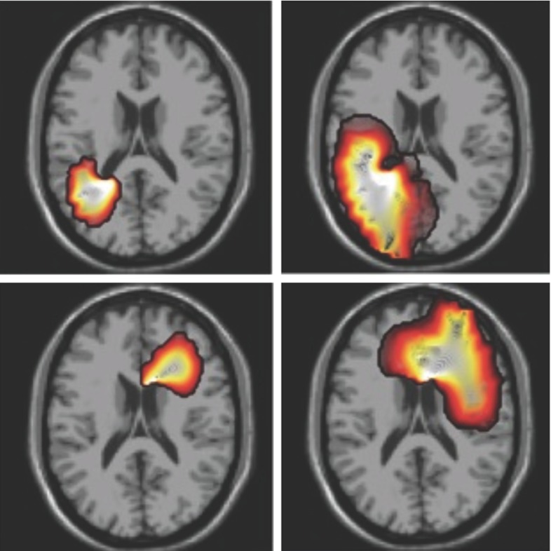 Fig. 13