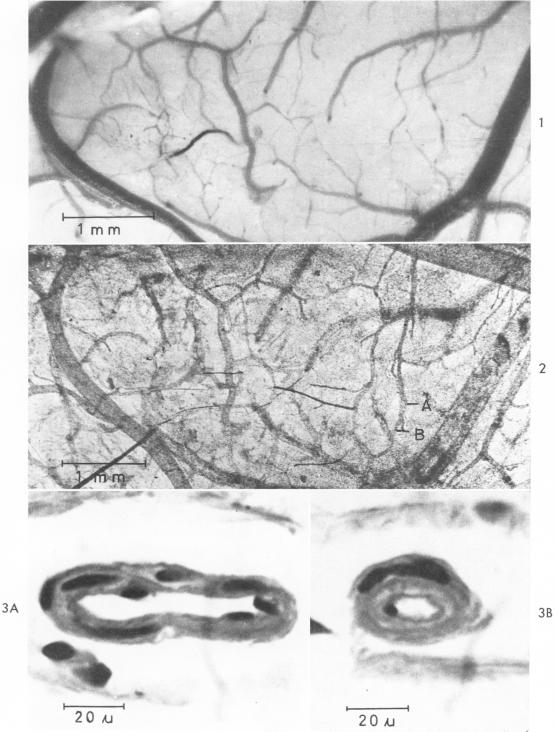 Figs 1-3