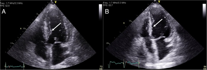 Figure 3