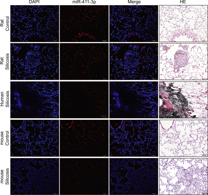 Figure 11