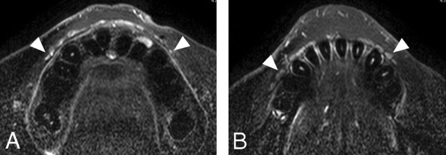 Fig 5.