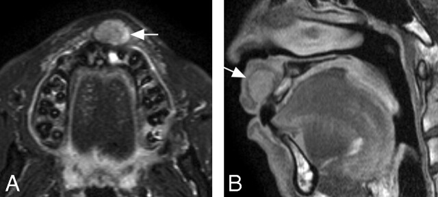 Fig 6.