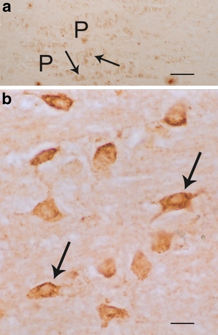 Fig. 4