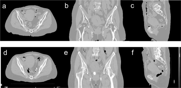 Figure 9