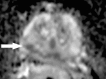 Figure 4d:
