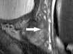 Figure 4c: