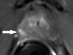 Figure 4f: