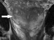 Figure 4b: