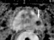 Figure 3d: