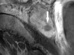 Figure 3c: