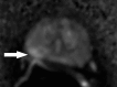 Figure 4e: