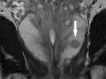Figure 3b: