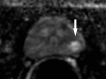Figure 3e: