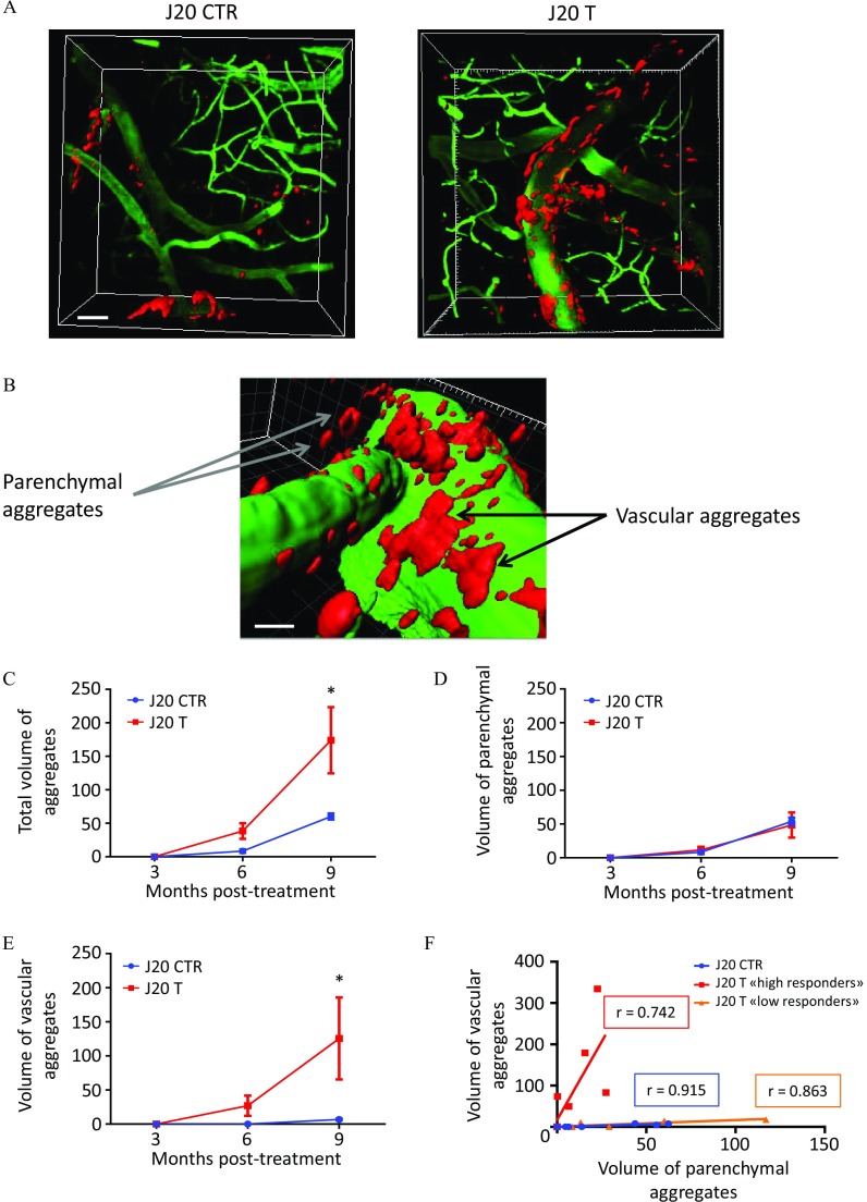Figure 9A comprises stained tissue J20 CTR and J20 T. Figure 9B comprises stained tissue, with the following labels: parenchymal aggregates and vascular aggregates. Figures 9C, 9D, and 9E are line graphs, plotting total volume of aggregates, volume of parenchymal aggregates, and volume of vascular aggregates (y-axis), respectively, ranging from 0 to 250 for J20 CTR and J20 T across 3 to 6 months posttreatment (x-axis). Figure 9F is a line graph, plotting volume of vascular aggregates, ranging from 0 to 400 (y-axis) for J20 CTR (r equals 0.915), J20 T high responders (r equals 0.742), and J20 T low responders (r equals 0.863) across volume of parenchymal aggregates, ranging from 0 to 150 (x-axis).