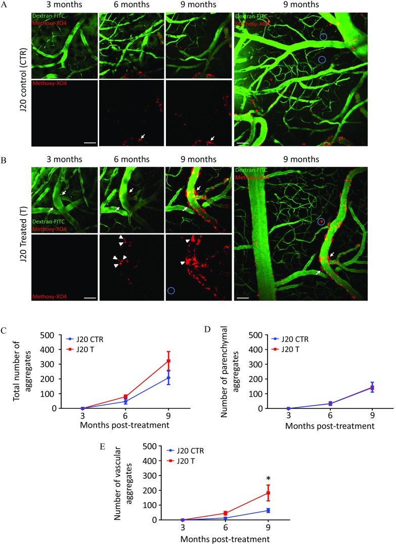 Figure 8A comprises four rows of stained cells. Across the breadth of the first, second, third, and fourth columns of the stained cells are 3 months, 6 months, 9 months, and 9 months, respectively. Across the first and second rows of the cells are J20 control (CTR). In the last column, the two rows have been combined, comprising dextran F I T C and methoxy XO4. The first cell in the first row of the first column comprises dextran F I T C and methoxy XO4. The first cell in the second row of the first column comprises methoxy XO4. Figure 8B comprises four rows of stained cells. Across the breadth of the first, second, third, and fourth columns of the stained cells are 3 months, 6 months, 9 months, and 9 months, respectively. Across the first and second rows of the cells are J20 treated (T). In the last column, the two rows have been combined, comprising dextran F I T C and methoxy XO4. The first cell in the first row of the first column comprises dextran F I T C and methoxy XO4. The first cell in the second row of the first column comprises methoxy XO4. Figures 8C, 8D, and 8E are line graphs, plotting total number of aggregates, number of parenchymal aggregates, and number of vascular aggregates (y-axis), respectively, ranging from 0 to 500 for J20 CTR and J20 T across months posttreatment, ranging from 3 to 9 months (x-axis).