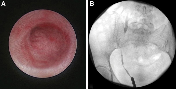 FIG. 2.