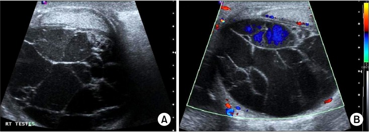 FIG. 1