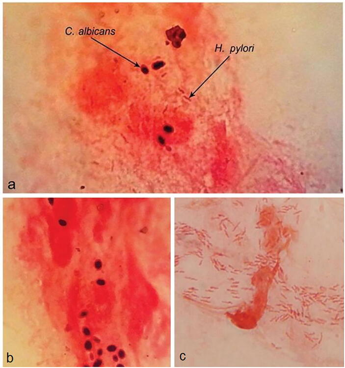 Fig. 1